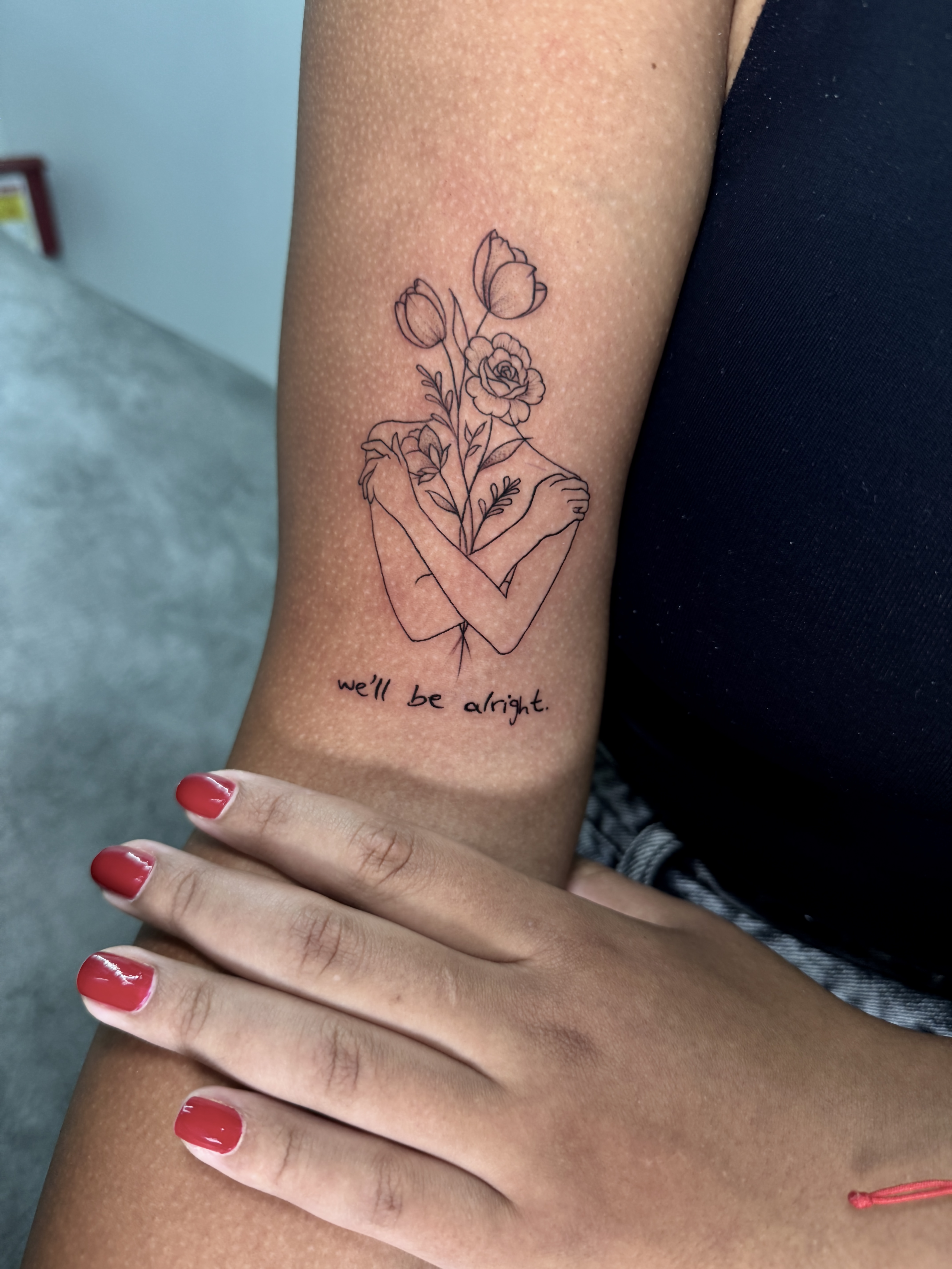 Fine line upper arm